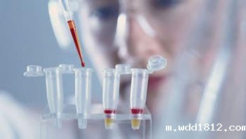 体检时生化分析仪检查肝功的必要性