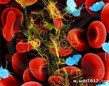 血液粘度测定的临床意义