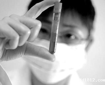 血流变检测仪的血液标本的采集与抗凝