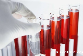 血液分析仪厂家