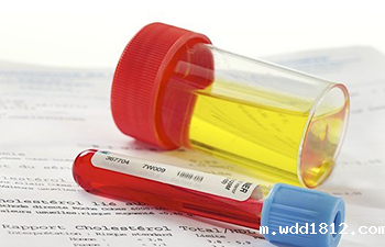 尿液分析仪厂家科普什么是血尿