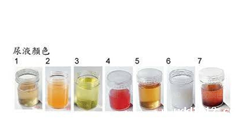 尿液分析仪品牌通过颜色判断疾病