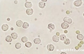 体育中国网址尿液分析仪解析尿液中白细胞的临床意义