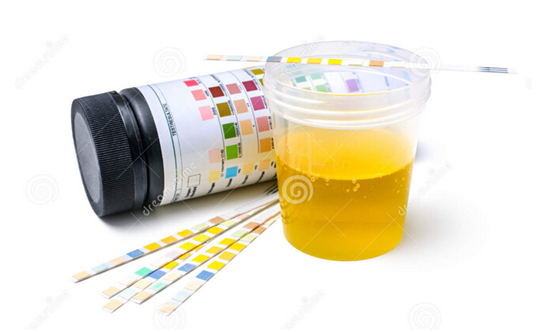 尿液分析厂家哪家好